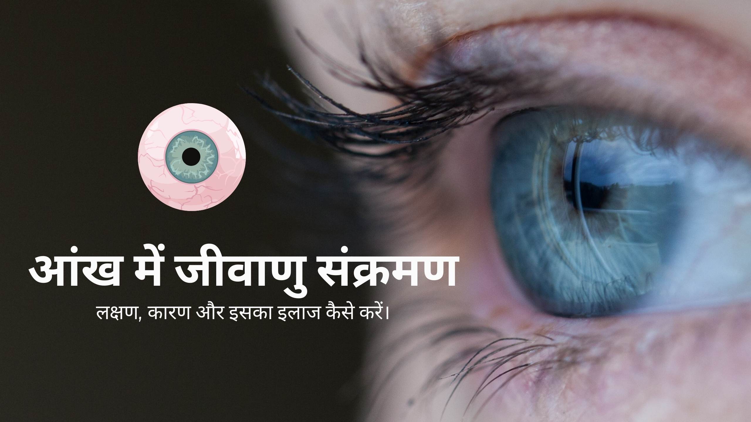 Bacterial infection in eye in hindi